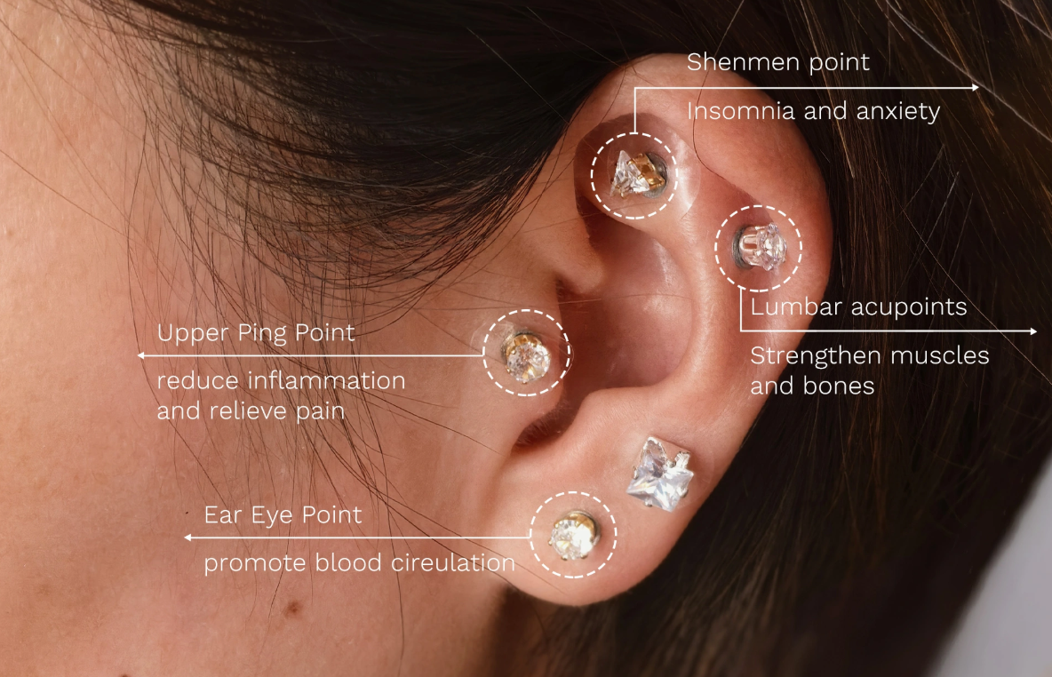 Shen Men point location for anxiety relief